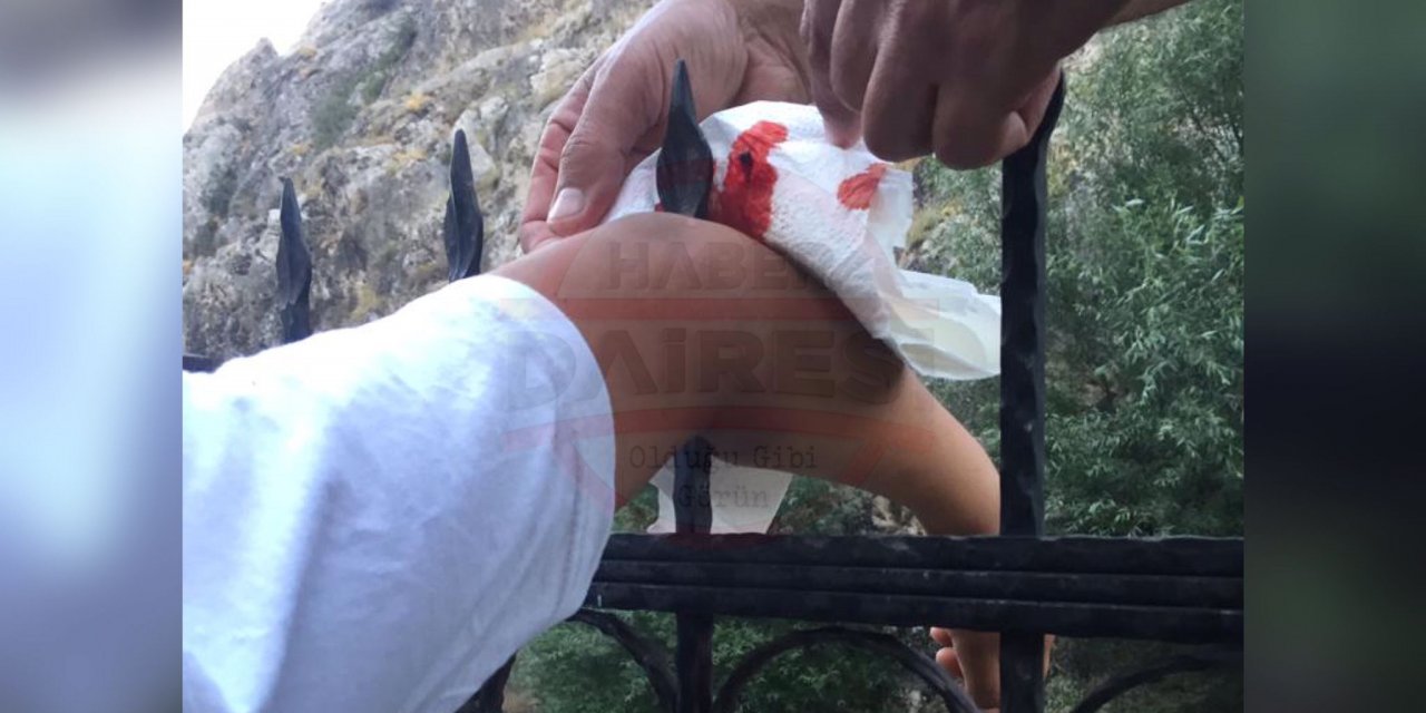 Konya’da bir çocuğun koluna demir korkuluk saplandı