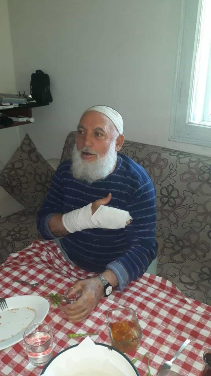 Kurbanlık pazarlığı ettiği adamın parmaklarını kırdı