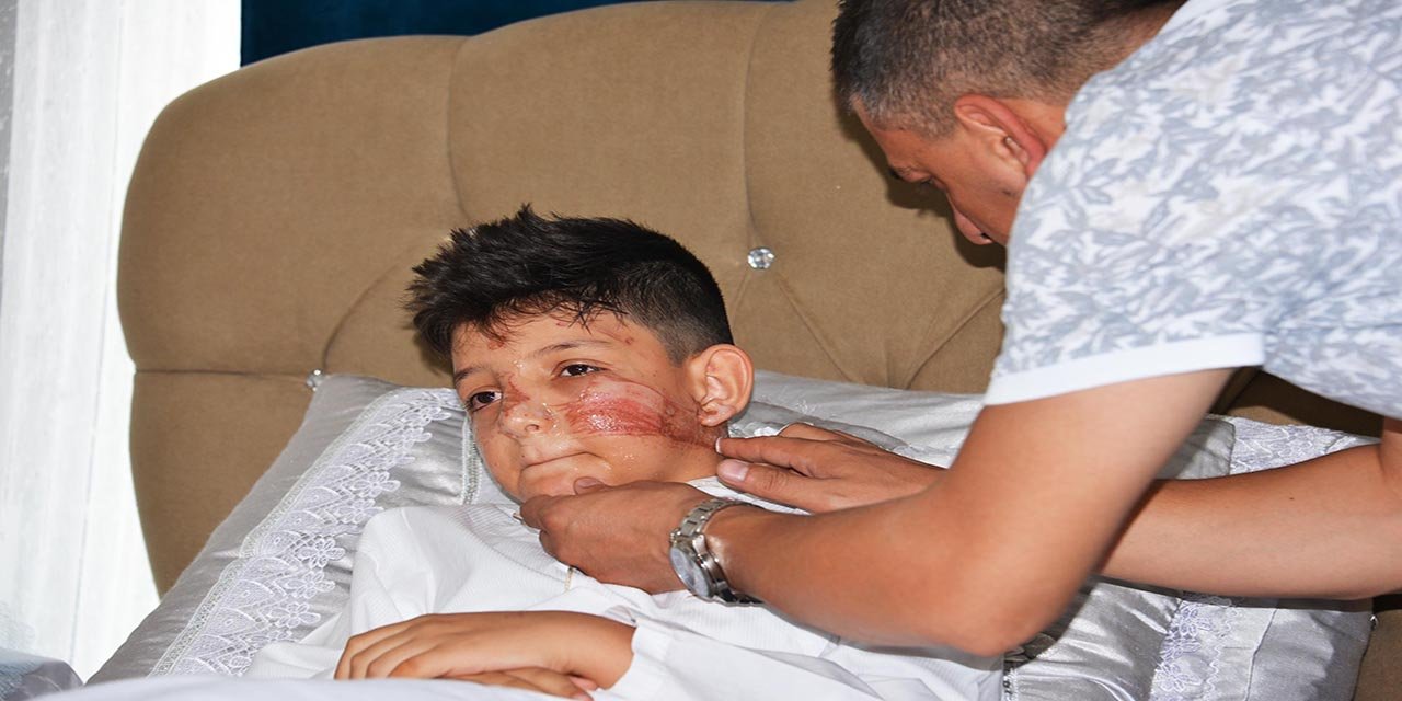 Bahşiş terörü! Sünnet çocuğunu bu hale getirdiler