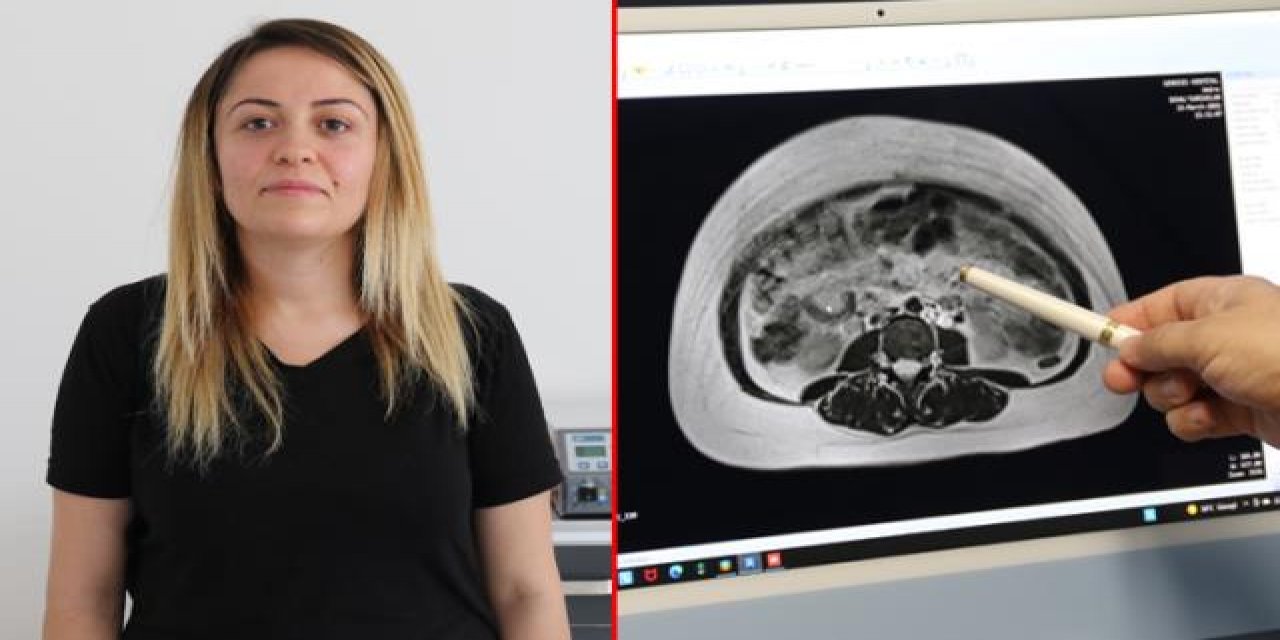 Yıllardır karnı şiş olan kadın, gerçeği doktora gidince öğrendi: Geceleri hareket ediyordu!