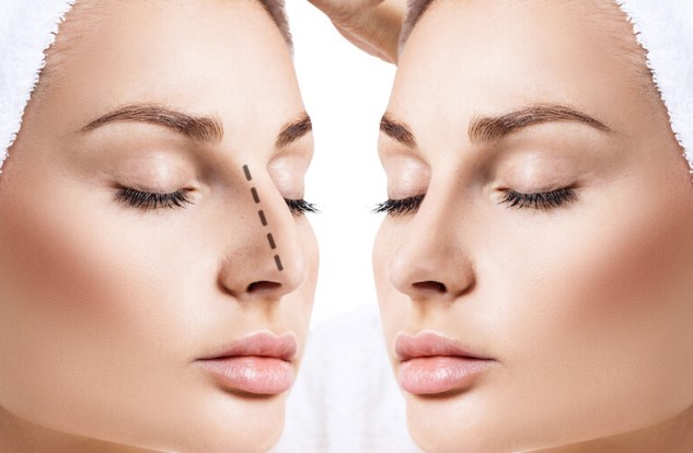 Kapalı Burun Estetiği Nedir?