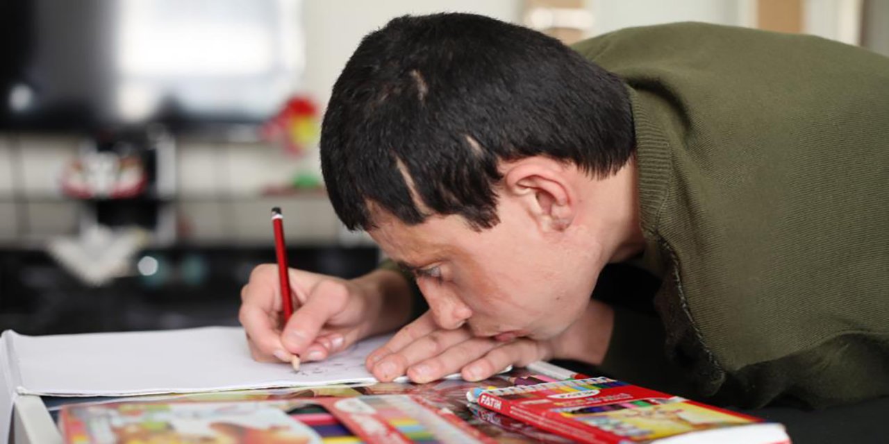 Konya’da komşunun kezzaplı saldırısında yaralanmıştı! Yaşam savaşı veriyor