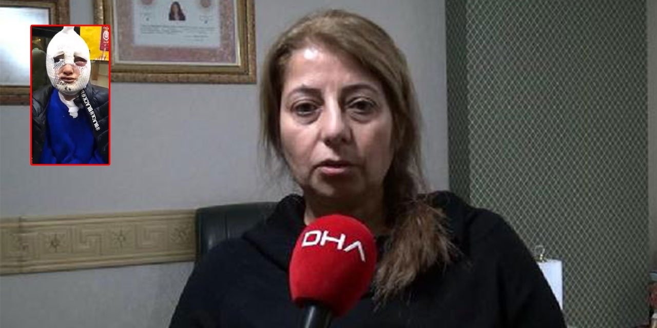 Başından aşağı kızgın yağ dökmüştü! Tutuklu sanık tahliye oldu