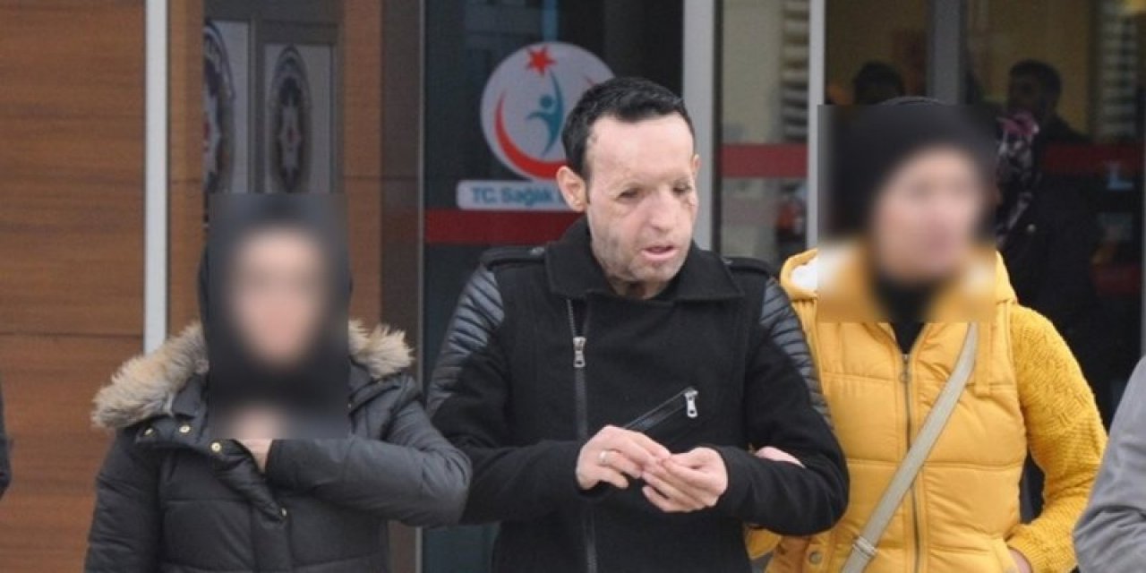 Yüz nakli yapılan Recep Sert gözaltında! İddia vahim