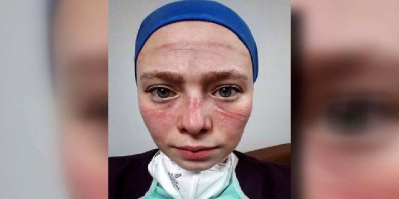 Seher Hemşire: Maske kullanımı kalktı ama izleri ve hatıraları bizimle