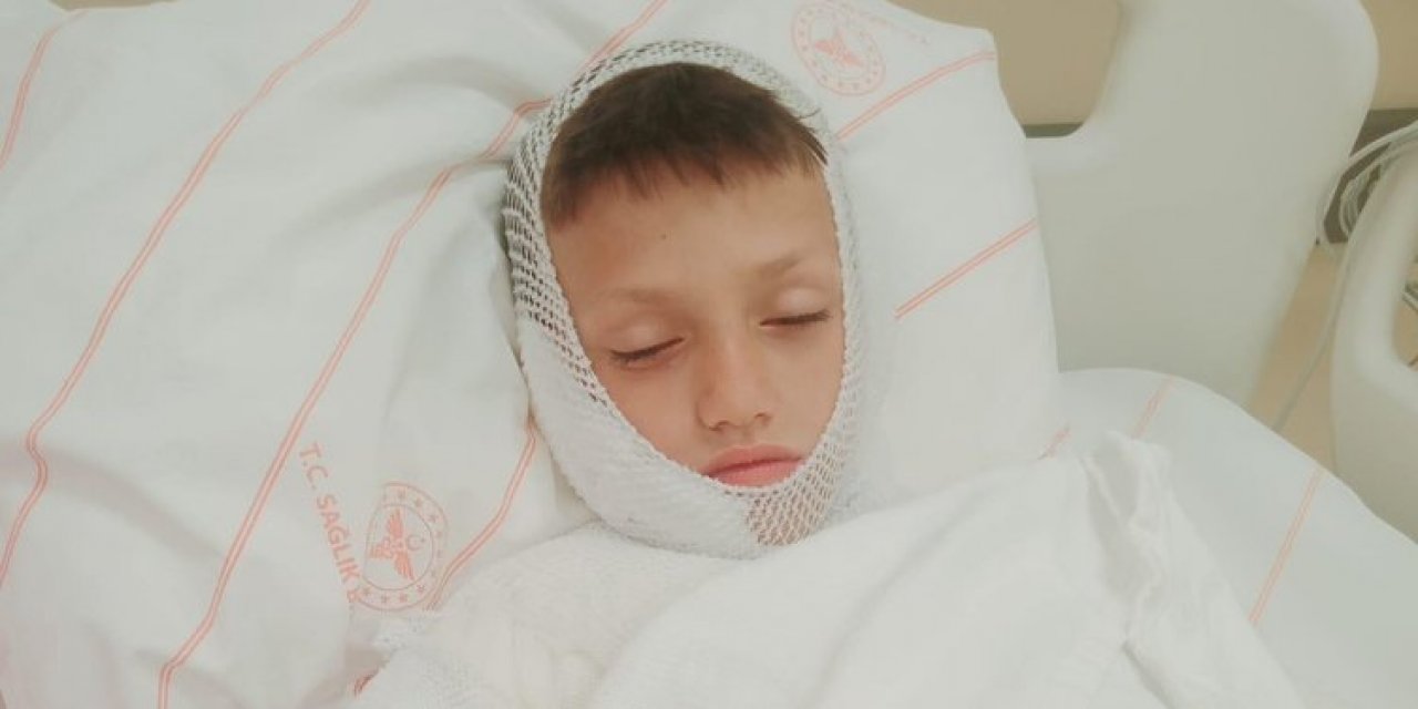 Konya’da çocukların oyunu sırasında kezzap dehşeti yaşandı