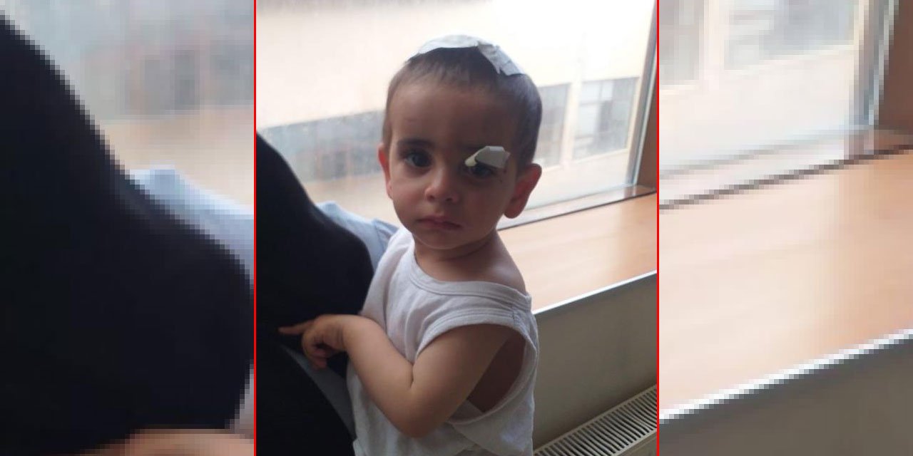 Köpeklerin saldırısına uğrayan 2 yaşındaki çocuk öldü