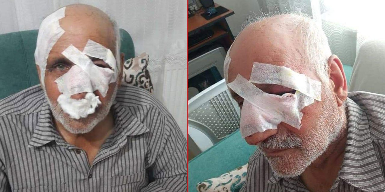 Köpek saldırısında yaralanan yaşlı adam 54 gün sonra öldü