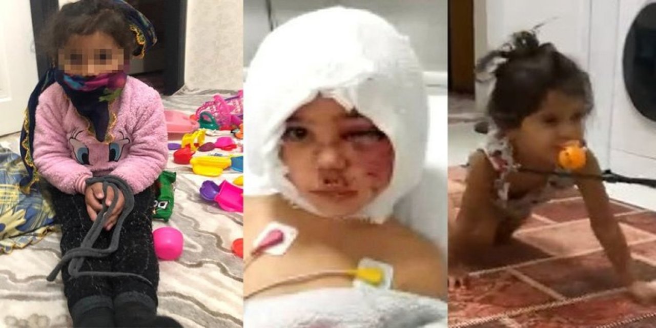 Türkiye’nin konuştuğu Asiye’nin annesiyle ilgili şok iddia! Tasma takmış