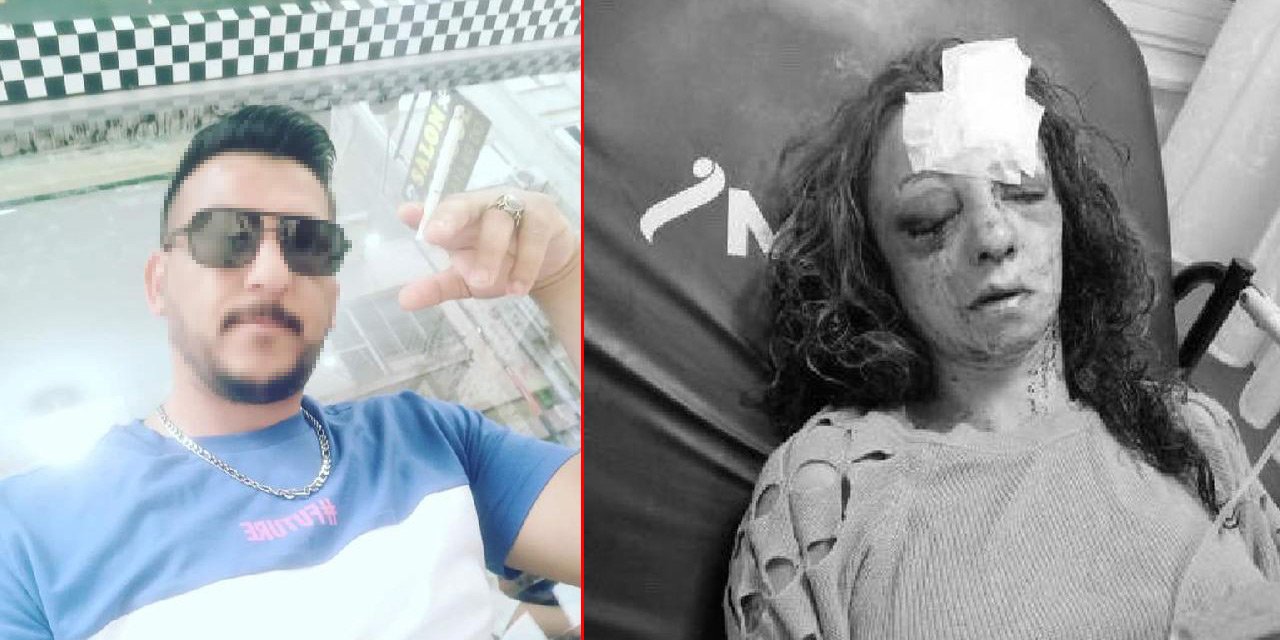 Genç kız, erkek arkadaşı tarafından demir krikoyla öldüresiye dövüldü