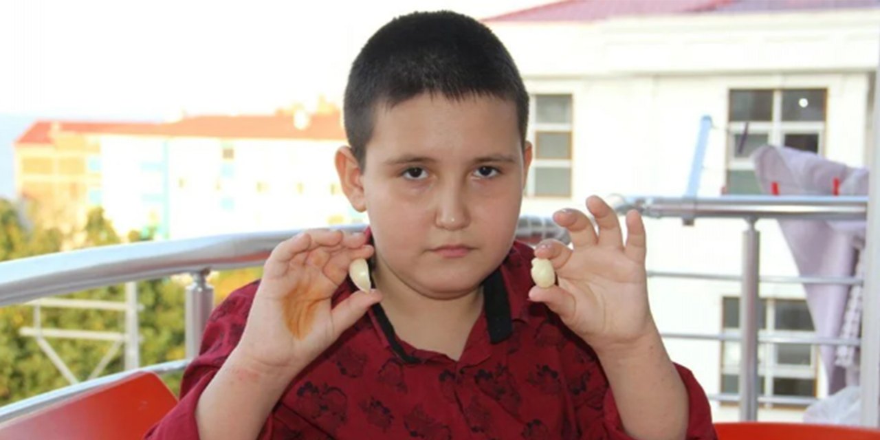9 yaşındaki Muhammed leblebi yer gibi sarımsak tüketiyor