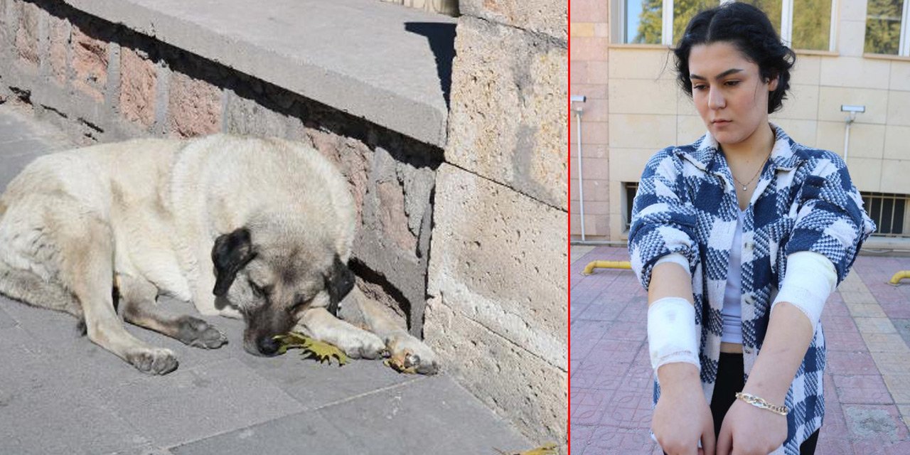 Üniversiteli Kübra, okula giderken 15 köpeğin saldırısına uğradı!