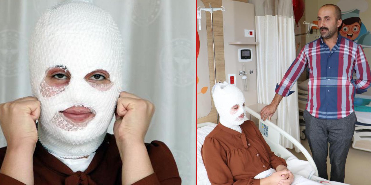 Düdüklü tencere bomba gibi patladı! 16 yaşındaki gencin vücudunda yanıklar oluştu