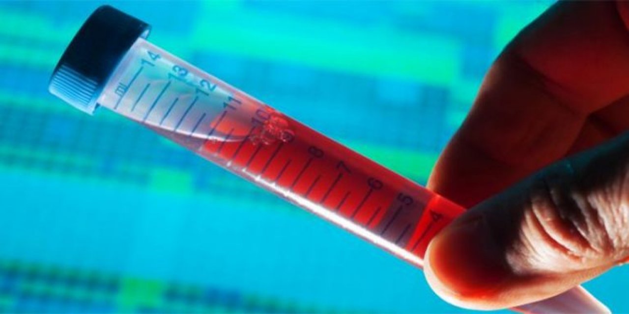 Hiv Testi Hakkında Genel Bilgiler