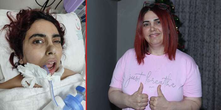 Doktorların yaşamaz dediği kadın, Konya’da hayata tutundu