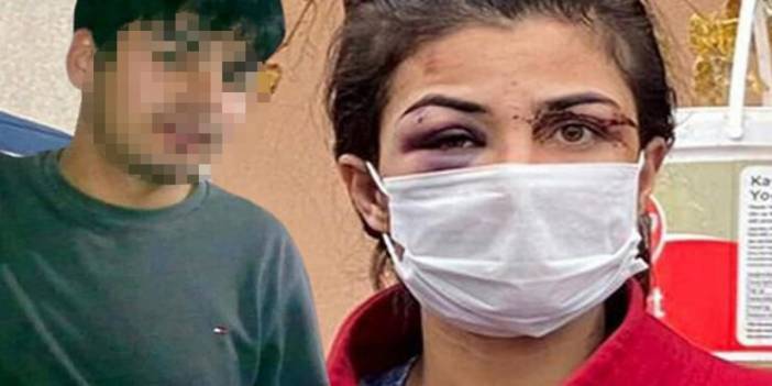 Öldürülen işkenceci kocanın dikkat çeken mermi paylaşımı: Parçalara ayrılıp damarları kesiyor