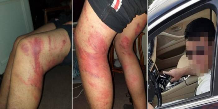 Konya’da çırağını triger kayışı ile döven ustanın cezası belli oldu