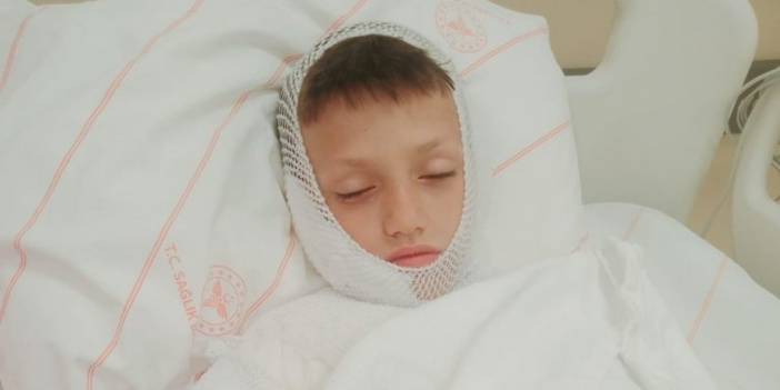 Konya’da çocukların oyunu sırasında kezzap dehşeti yaşandı