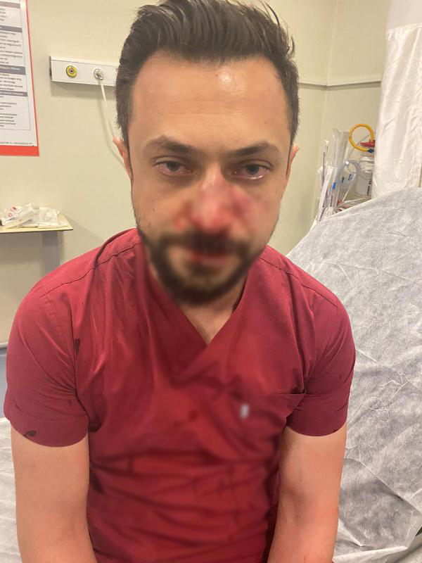 hasta-yakininin-saldirisina-ugrayan-doktorun-burnu-kirildi-002.jpg
