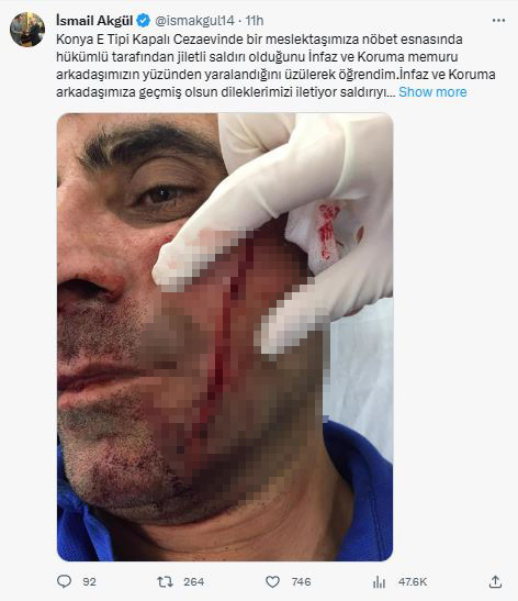 konyada-cezaevinde-infaz-memuruna-jiletli-saldiri.jpg