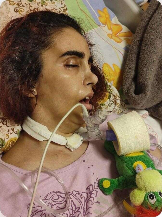 doktorlarin-yasamaz-dedigi-kadin-konyada-hayata-tutundu