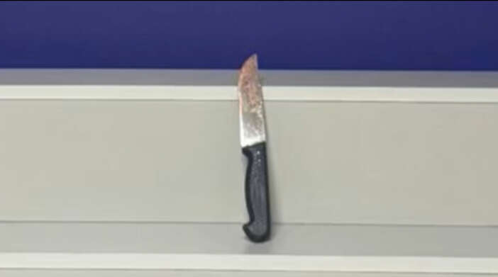 mal-paylasimi-kavgasi-ogul-babasini-sirtindan-bicakladi