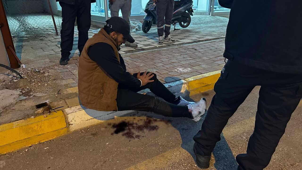 sokak-ortasinda-bicakladilar-cocuklara-verdigi-sigara-canindan-ediyordu