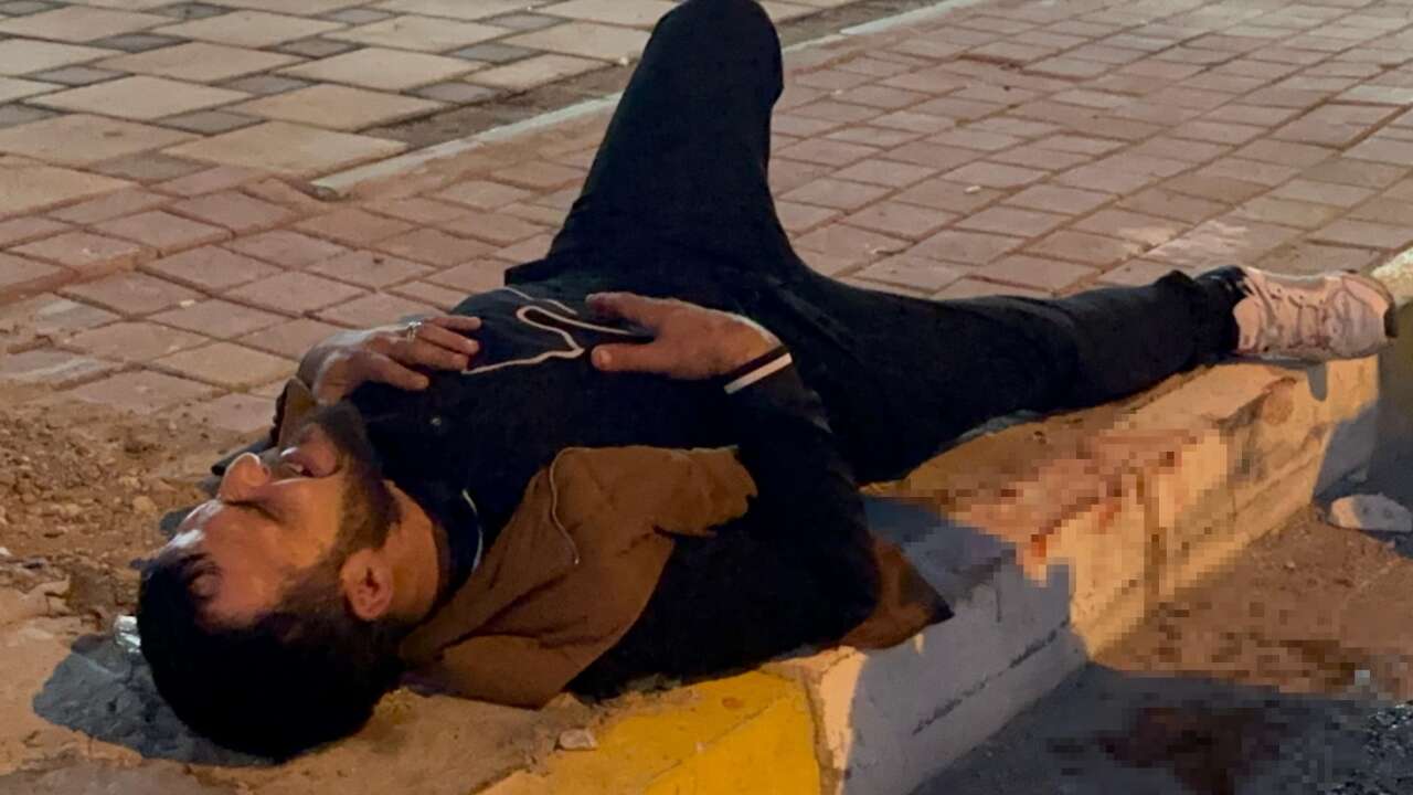 sokak-ortasinda-bicakladilar-cocuklara-verdigi-sigara-canindan-ediyordu