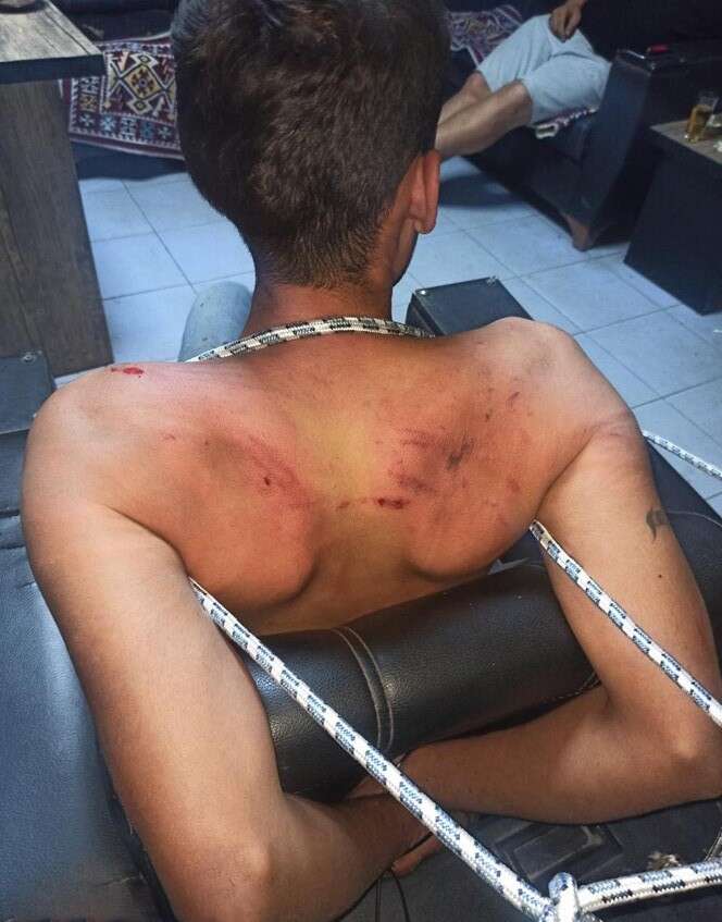 hamam-bocekli-iskencede-karar-cikti