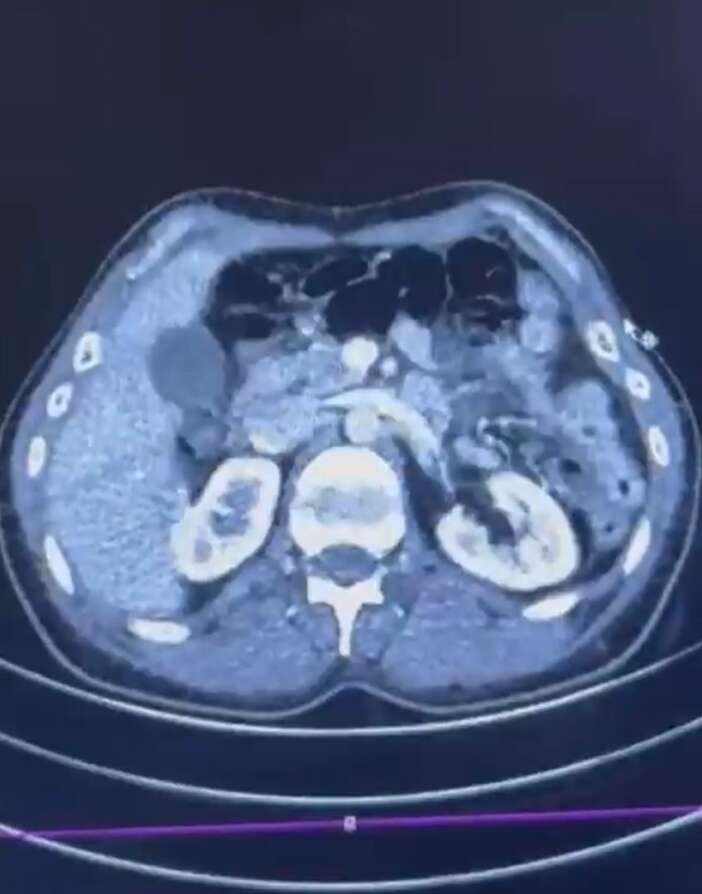 her-sey-hastane-muayenesinde-ortaya-cikti-3-kisi-gozaltina-alindi