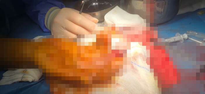 kopan-parmagini-posete-koyup-turkiyeye-geldi