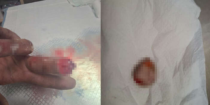 kopan-parmagini-posete-koyup-turkiyeye-geldi