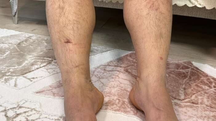 kuzenleri-dehseti-yasatti-anlattiklari-kan-dondurdu