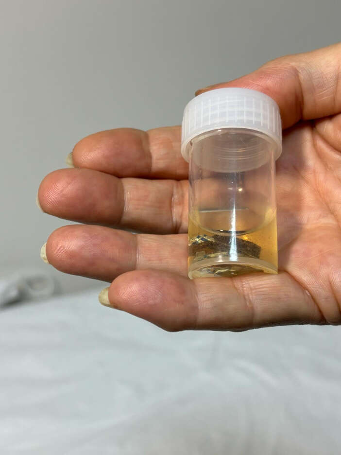 aluminyum-kabiyla-yuttugu-hap-4-yil-son-1070167-317566