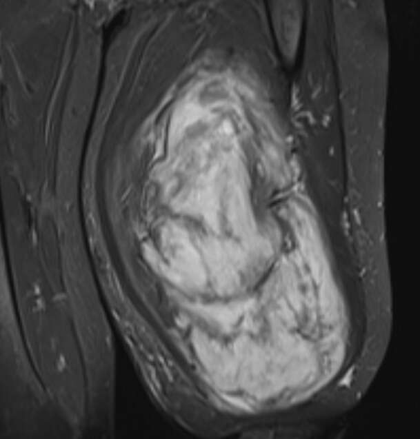 cikan-kitle-hayrete-dusurdu-tam-5-kilo-668-gram