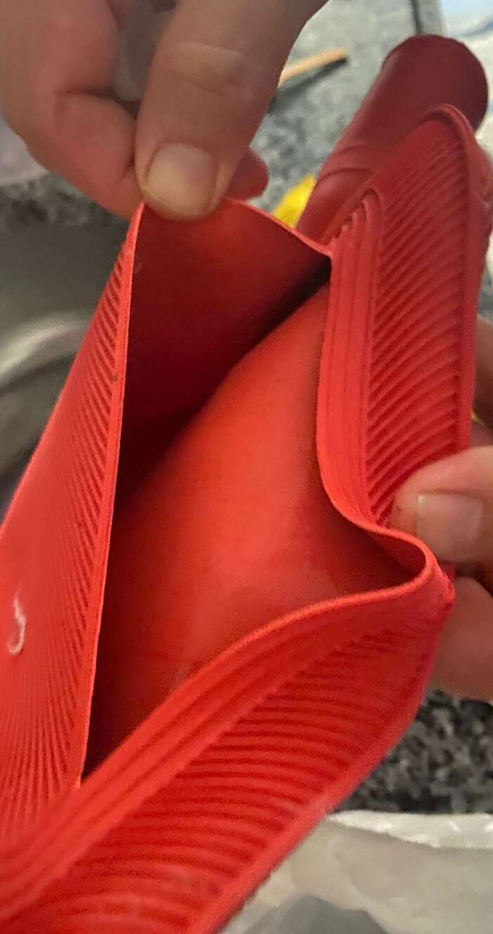 sicak-su-torbasi-patladi-genc-kizin-vucudu-yandi