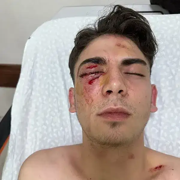 konyada-kor-eden-mustali-saldirida-yeni-gelisme-tekrar-gozaltina-alindilar