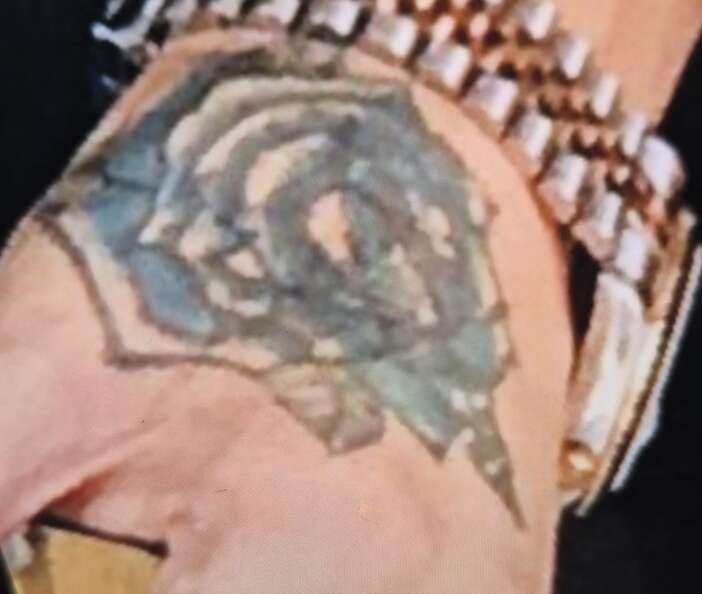 dovme-sildirmek-isterken-elinden-oldu-nakil-gerekiyor