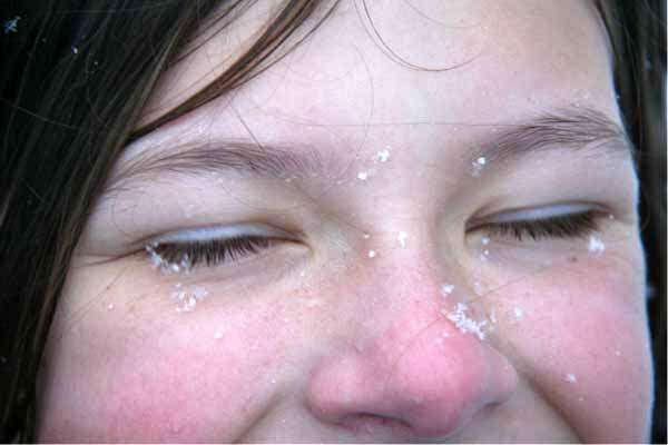 konyada-uzmanindan-yuz-felcinde-72-saat-uyarisi