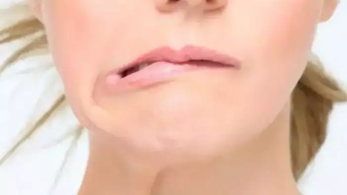 konyada-uzmanindan-yuz-felcinde-72-saat-uyarisi