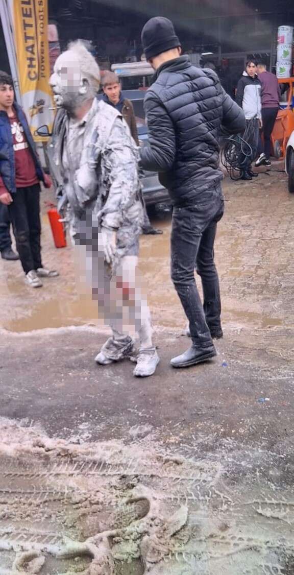 oto-elektrik-dukkaninda-patlama-1i-agir-4-yarali-var