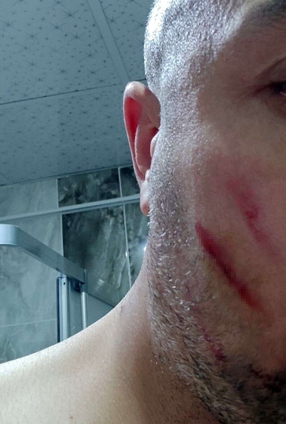 otobusteki-yolcu-tuvalete-gitmek-istedi-ortalik-savas-alanina-dondu