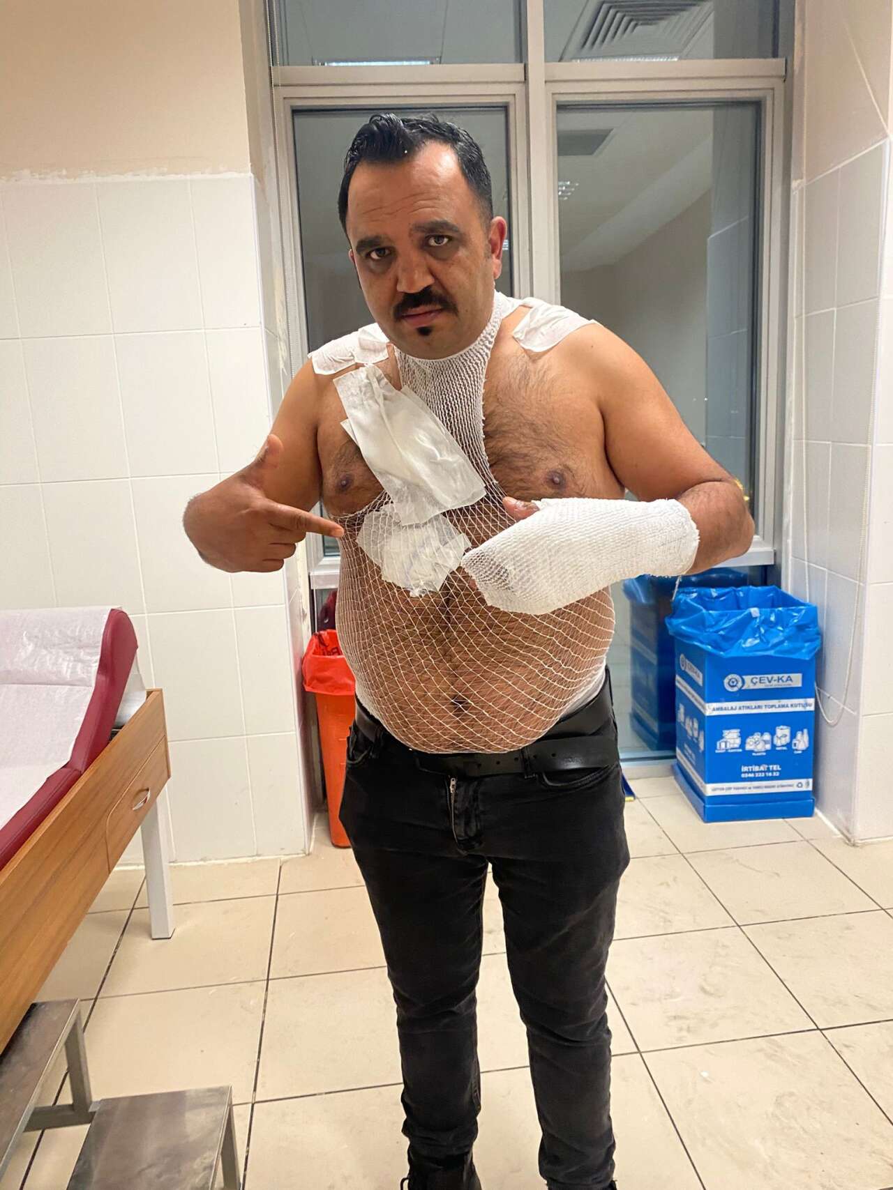 unlu-tostcu-sov-yaparken-kendi-kendini-yakti