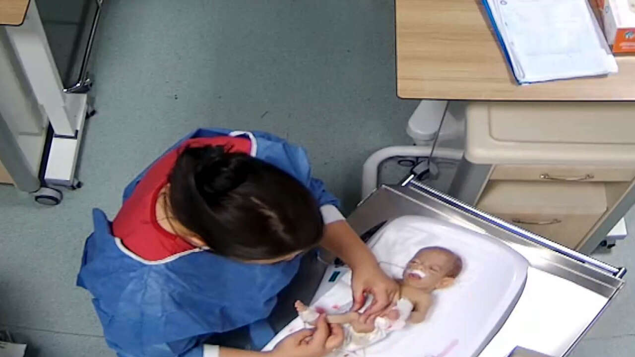 5-gunluk-bebege-hemsire-siddeti-kamerada-omur-boyu-engelli-kaldi