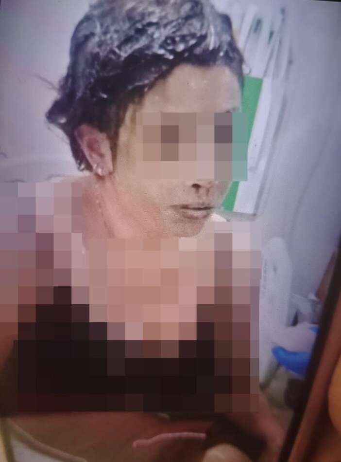 kezzapli-saldiri-eski-karisina-dehseti-yasatti