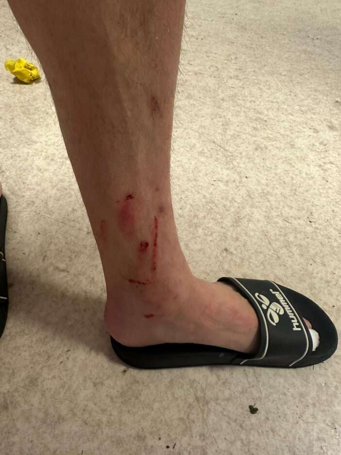 konyasporlu-berkan-kutlunun-yaralandigi-pozisyon-olay-oldu