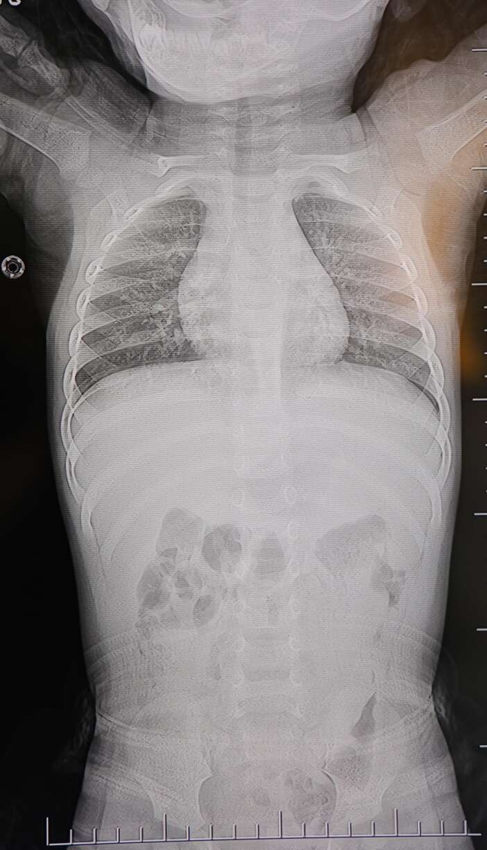 sirt-ustu-yatinca-aglayan-bebegin-icinden-cikan-korkuttu