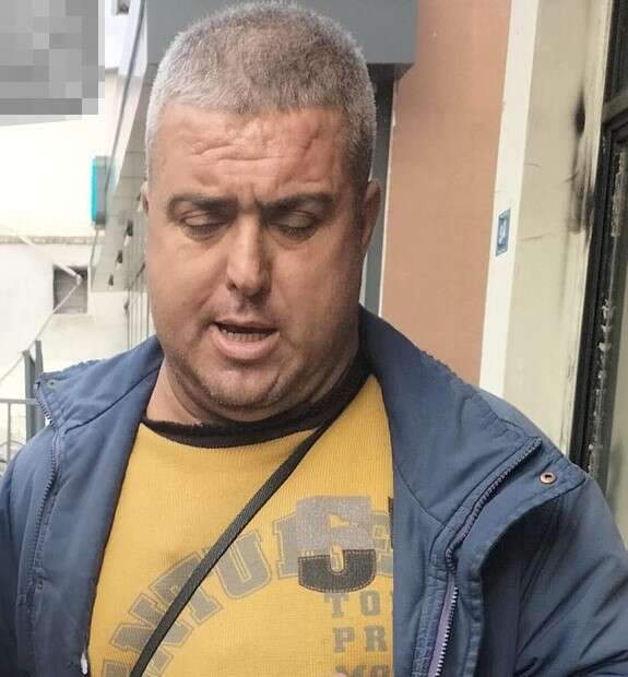 sessiz-katil-baba-ile-kizini-oldurdu-2-kisiyi-hastanelik-etti