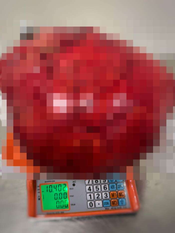 kilo-aldigini-zannederken-gercek-bambaska-cikti-hemen-ameliyata-alindi