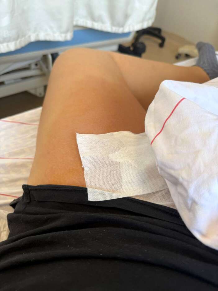 guzellik-merkezindeki-yanlis-islem-ameliyatlik-yapti